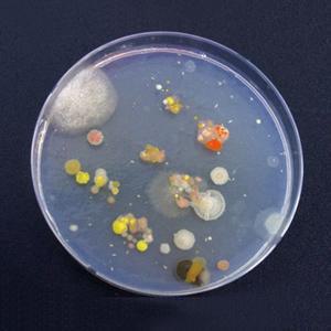 배지만들기(세균.영양분 혼합물)