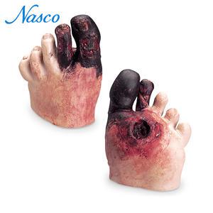 [NASCO] 나스코 당뇨로 인한 발궤양 모형 WA21216