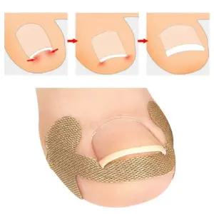 내성발톱 보호스티커 발톱관리 발톱케어 페디밴드 내성발톱스티커