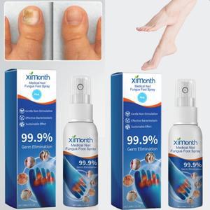 진균 제거 풋 스프레이 무좀 올인원 발가락 간지러움 발냄새 곰팡이균 발 관리 스프레