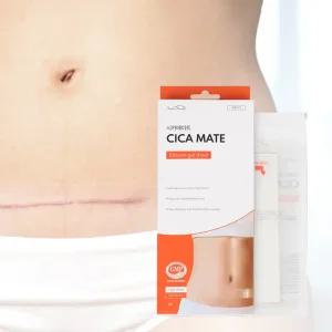 시카메이트 15x3cm 1mm 시카케어 밴드 실리콘 겔 시트 제왕절개 흉터제거 켈로이드 관리