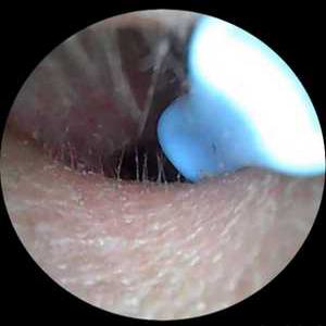 마카사조 내시경귀이개 귀내시경 귀이개 조명 귀청소 귀파개 귀지제거 귀청소기 귀후비개 집게 핀셋귀지집