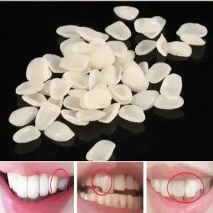 국내 미용 모형치아 키트 임시 가짜이빨 미국 판매 셀프 성형 가공 프리 사이즈 50ea