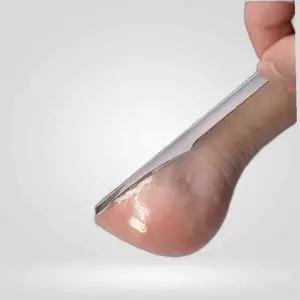 스텐 발각질 제거 나이프 페디 각질 제거 굳은살제거나이프 나이프 스텐나이프 패디나이프