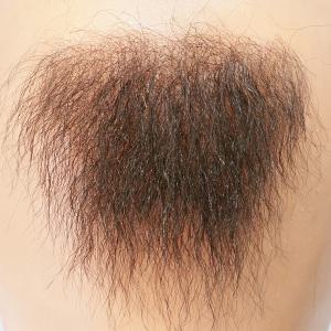 여성 빈모증 여자 무모증 남성 남자 음모패드 무모 빈모 무모증클리닉 서울 강남 청담 대전 대구 광주 수원 경기 강원 창원 거제 울산 포항 거제 제주 체모 털 브라질리언왁싱