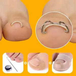 바른톱 양방향 내성 발톱 교정기 내향성 교정 파고드는 셀프 치료 밴드 1세트