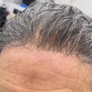 80Density Undetectable 1B65 회색 남성 부분 가발 100% 인도산 인모 남성용 가발 초박형 0.03mm 스킨 베이스 투명 헤어피스