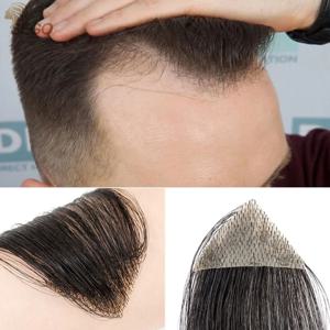 SEGO 인간의 머리카락 교체 패치 남성 여성을위한 머리카락없이 우발적 인 화상 교체 Toupee의 헤어 라인 손실 스트레이트 테이프