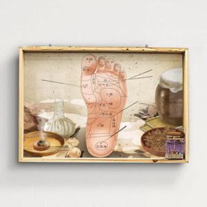 아트박스/꾸밈 pf882-우드프레임액자_손과발의혈자리