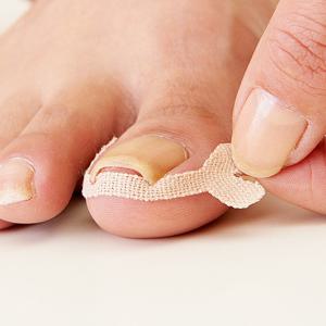 [일본아이디어쇼] 내성발톱 케어 테이프