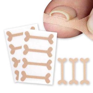 발톱밴드 파고드는 발톱 테이프 밴드 48매 (WC4D591)