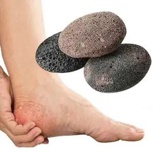 발뒤꿈치 각질제거 돌 화산석 발굳은살 바닥 발뒷꿈치 관리