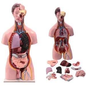 학교 질병교육 장기교구 장기 암 질병 발생 인체모형 탈부착가능 의학교구