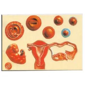 학교 과학 보건수업 정자 착상 태아형성과정 판넬 60x40cm 성교육 태아신비