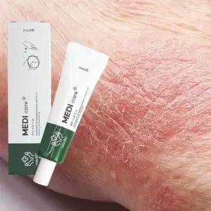 건성 피부 진정 크림 건선 가려움증 진물 습진 연고