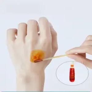 면봉 일회용스틱 포비돈 300개 요오드 응급 비상