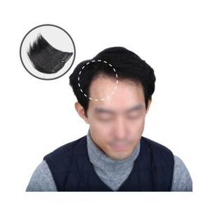 남자 남성 m자 이마 엠자 탈모 앞머리 부분 가발