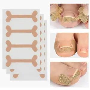 (색상 본품)(12개입세트)테이프 내성발톱 교정기 파고드는 내향성 발톱 교정 밴드 프로