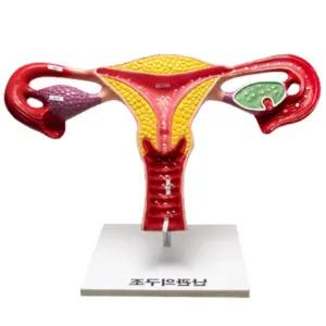 학교 과학실 보건수업 인체교육 실물크기 여자 난관의구조 모형 실험도구