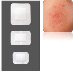 엉덩이 종기 패치 10매 겨드랑이 패치 피지낭종 목종기 튀어나온점 제거 큰점