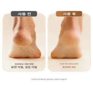 두우둥 전동발각질제거기 발각질제거기 뒤꿈치 풋케어