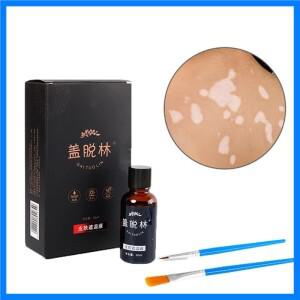 30mlVitiligo Leukoderma 커버링 액체 방수 컨실러 크림 액체 여성 남성 얼굴 변색 피부 Vitiligo Patches
