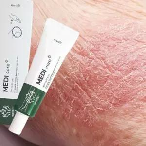 (다올)건선연고 건성 피부 진정 크림 습진 가려움증 연고