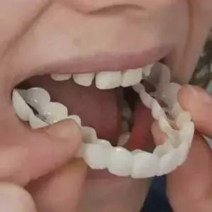 가짜 이빨 임시치아 탈부착