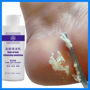 120ml 발 각질 제거제 7초 만에 각질 및 굳은살 제거 발 마스크 갈라진 발뒤꿈치 개선 네일 페디큐어 키트
