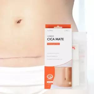 시카메이트 15x3cm 1mm 시카케어 밴드 실리콘 겔 시트 제왕절개 흉터제거 켈로이드 관리