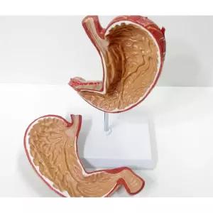 병원 생물 의학 교육 인체 위 장기 모형 보건 피규어