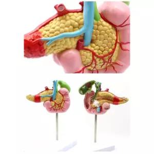 담낭 췌장 의학 보건 병리학 인체 해부 모형 피규어
