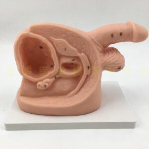 남성 및 여성 내부 외부 생식기 해부학 모델 소변 카테터 몰드