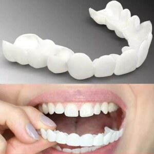 마우스 틀니 임시 슬리브 의치 키트 1. 화이트닝 인공 인공물 트레이