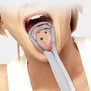 혀클리너 설태제거기 2개