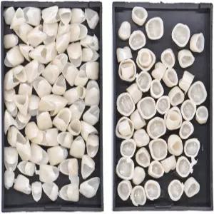 앙질리 2박스 치과 임시 크라운 베니어 치아 캡 앞니 용품용