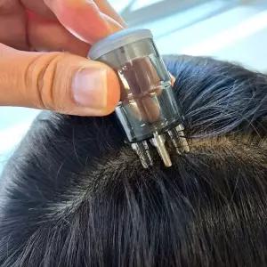 셀프 에센스 관리기 미니 케어 관리용 도포 투입 앰플 두피팩 미용실 두피 마사지기 영양공급 5ml