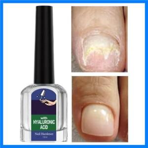 손톱 강화 드롭 천연 깊은 영양 공급 부서진 손발톱 관리 액체 여행 기숙사 체육관 가정 아파트 여성용