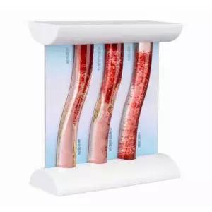 동맥 고지혈증 혈관 모형 고지혈증모형 해부학 의대 막힘 지질 심혈관