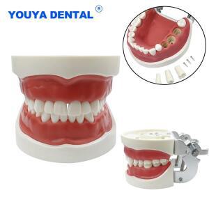 치과 실습용 32개 치아 모형 타이포돈트, 잇몸이 있는 턱 탈착식 기술자 시연용