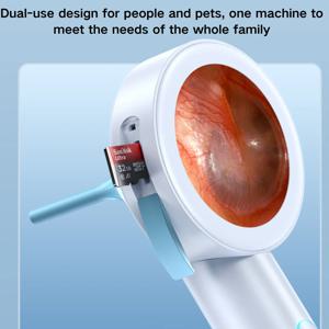 1.8인치 화면 귀 카메라 즉시 켜기/녹화, 어린이/성인/개/고양이용 가정 및 애완동물용 오토스코프, HD 비주얼 귀 청소기