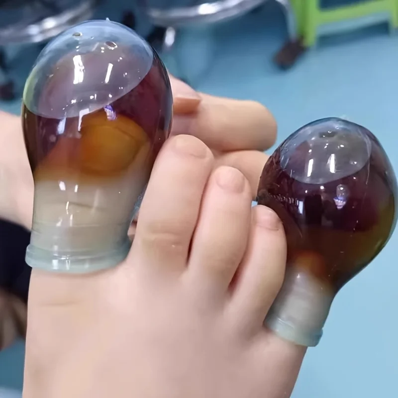 1개입 부드러운 실리콘 발가락 보호대, 마찰 감소 및 손톱 삽입 방지, 상처 관리 및 피부 감염 예방