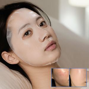 72샷 메디크림 마스크 4매 진정 장벽강화 보습 마스크팩