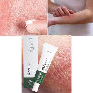 피부보습제 얼굴열감 노인피부 등 다리가려움증 손가락 손톱건선 지성 수분 고보습 크림 연고