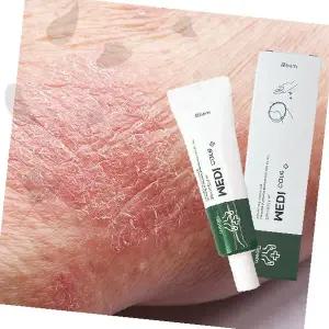 메디케어 건선 습진  피부염 가려움 진정 크림 튜브형 케어