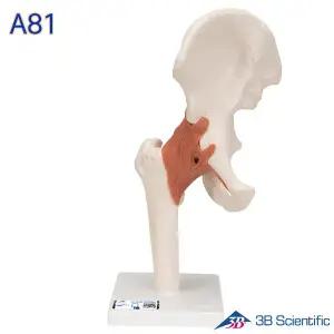[종로의료기]3B Scientific 인체모형 A81 고관절모형 엉덩이뼈 관절과 인대