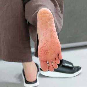 [다이어트학교]부끼톡스 리압슬리퍼 다이어트 붓기 지압슬리퍼 사무실슬리퍼