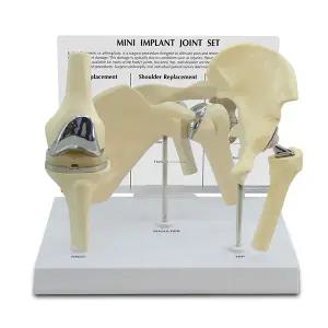 [GPI] 미니 임플란트 관절모형 세트 G191