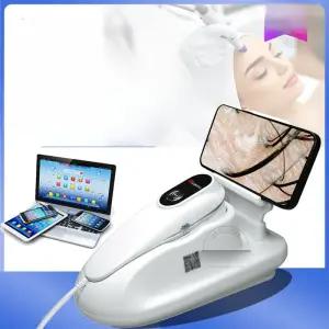 두피 모발 분석기 피부 진단기 휴대용 고화질 USB 현미경 모공 확대 검사 헤어샵 미용실용 탈모 예방 측정 장비