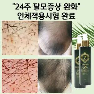 두피 영양 탈모케어 제르넬 스칼프 에센스 2개